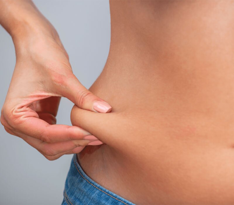 Abdominoplasty Cost in South Delhi