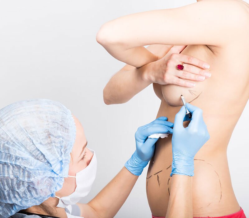 Breast Augmentation Cost In South Delhi